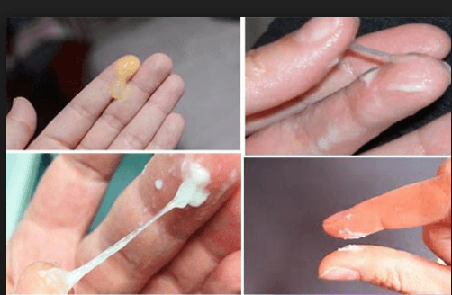 Triệu chứng nhận diện viêm phụ khoa