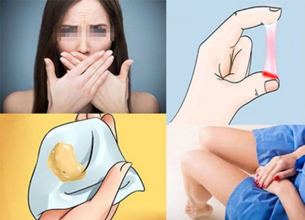 Khí hư bất thường do bệnh lý