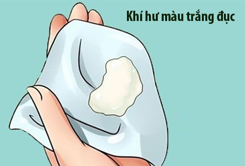 Khí hư màu trắng đục – 10+ Bí mật đằng sau ít người biết