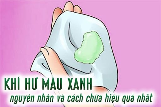 Khí hư màu xanh: Cảnh báo nhiều bệnh lý nguy hiểm + cách chữa