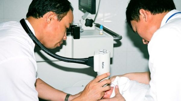 bênh viện mắt TW