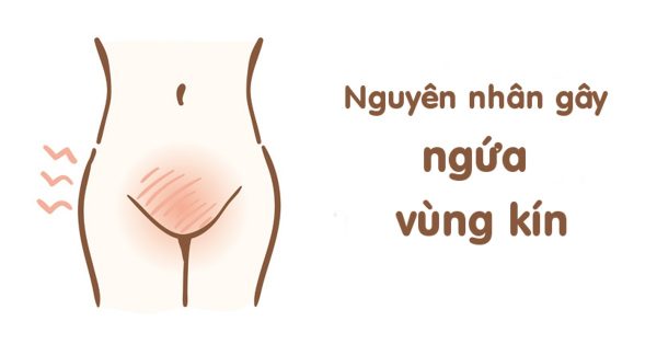 [Ngứa vùng kín bên ngoài] Từ A- Z nguyên nhân, nguy hại, cách chữa