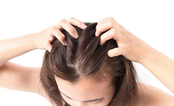 triệu chứng nấm da đầu