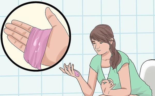 Nguyên nhân và biểu hiện của ngứa vùng kín