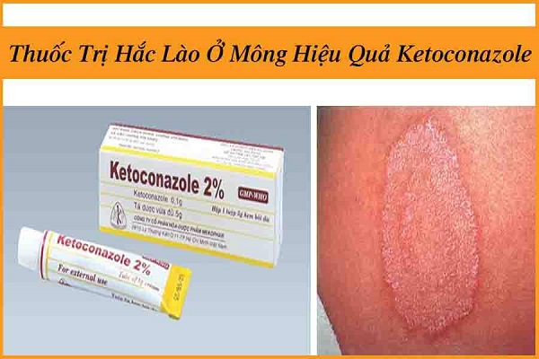 thuoc tri benh hac lao