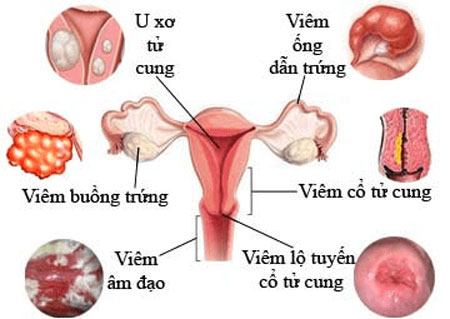 7+ Bệnh lý nguy hiểm do khí hư màu nâu đỏ gây ra
