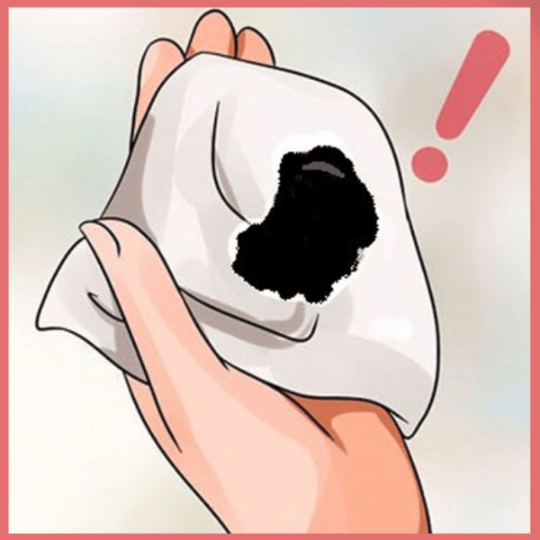 Khí hư màu đen vón cục