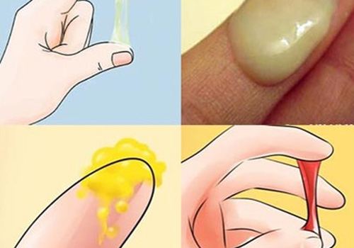 Nhận biết bà bầu ra nhiều khí hư khi mang thai tháng cuối