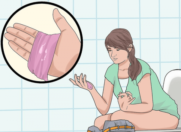 Khí hư màu trắng – Dấu hiệu cảnh báo 6+ bệnh phụ khoa nguy hiểm