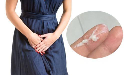 Ra nhiều khí hư có phải mang thai không