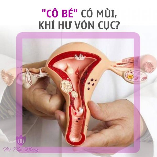 Khí hư vón cục: Nguyên nhân và cách điều trị hiệu quả