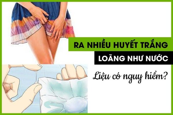 [ Khí hư ra nhiều loãng như nước ] Nguyên nhân và cách chữa dứt điểm