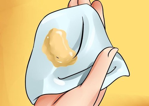 Khí hư màu vàng đặc dính do đâu?