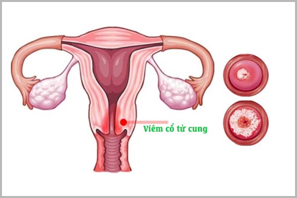 Nhận biết khí hư dấu hiệu mang thai