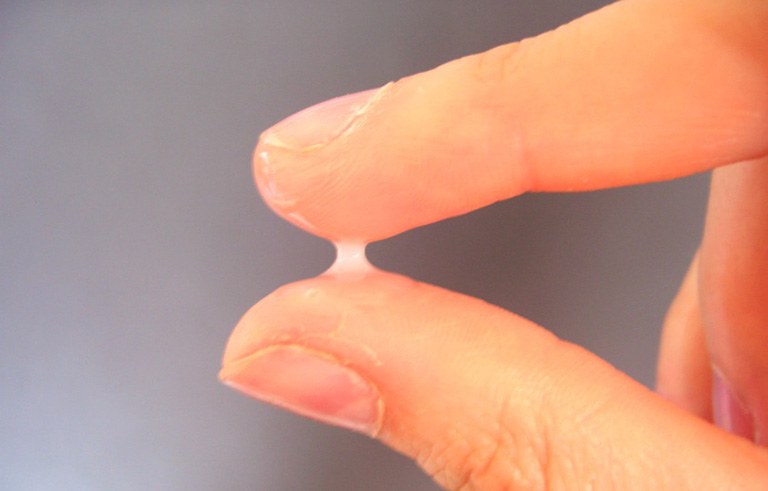 [ Cùng tìm hiểu] Khí hư màu trắng đục như bã đậu