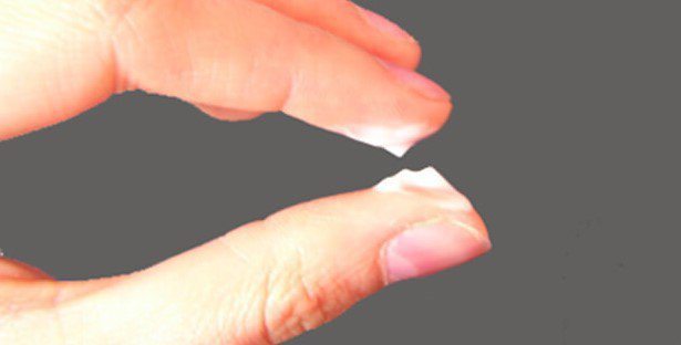 [Khí hư màu trắng]: Vấn đề chị em không nên bỏ qua