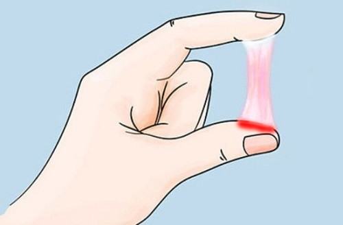 Khí hư có máu: Dấu hiệu cảnh báo 7+ bệnh lý nguy hiểm