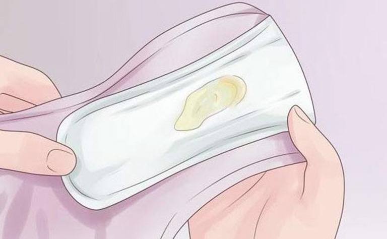 Khí hư màu vàng: 10+ Nguyên nhân phổ biến nữ giới nên biết