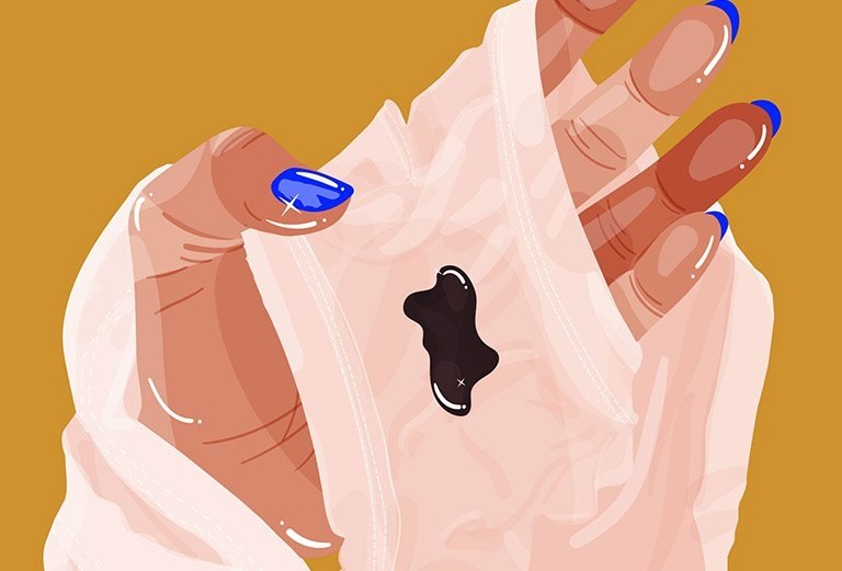 Khí hư màu đen: Dấu hiệu cảnh báo bệnh ung thư cổ tử cung