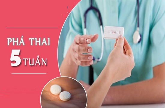 Phá thai 5 tuần tuổi: 8 Thông tin quan trọng thai phụ nên biết
