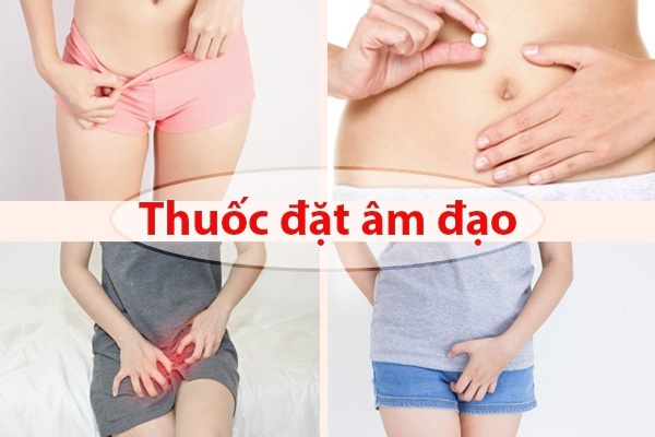 Viêm âm đạo dùng thuốc gì? Top 15 thuốc chữa viêm âm đạo tốt nhất