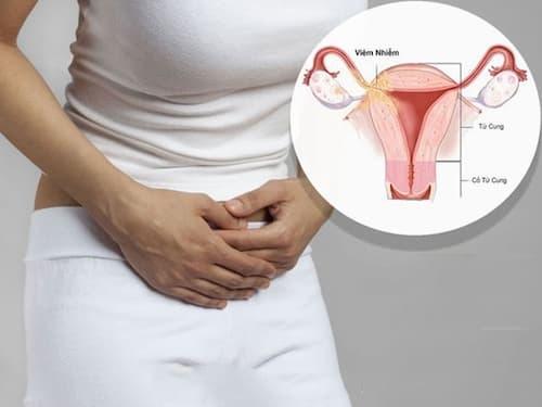 Viêm ngứa vùng kín ở bà bầu nguyên nhân do đâu?