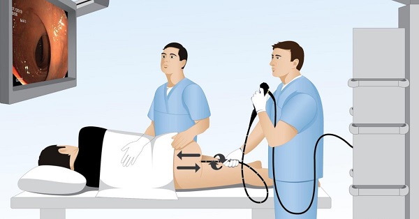 Nội soi dạ dày, đại tràng ở đâu tốt TP HCM? Top 15+ địa chỉ uy tín