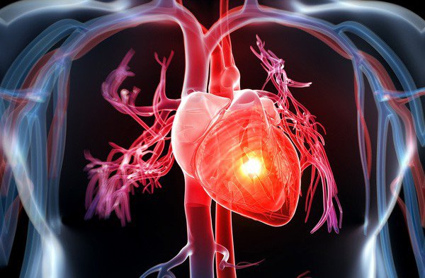 Thế nào là bệnh tim mạch