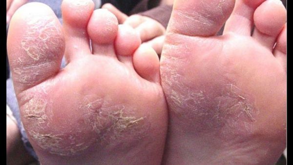 bong da chân là gì