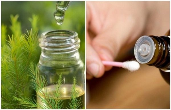 Trị mụn bọc ở mũi bằng tinh dầu tràm trà
