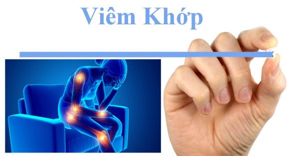 Địa chỉ khám viêm khớp uy tín tại Hà Nội