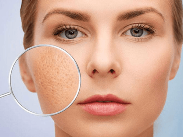 10+ Thói quen khiến lỗ chân lông to và cách khắc phục hiệu quả tại nhà