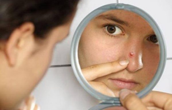 Lưu ý khi xử lý mụn bọc ở mũi