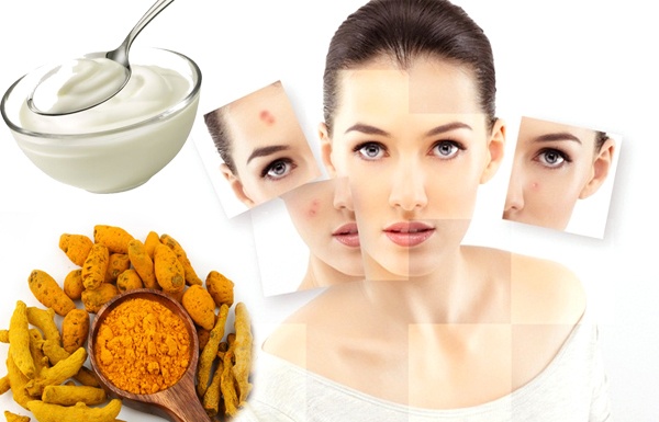 Công thức loại bỏ mụn bọc từ nghệ ít người biết