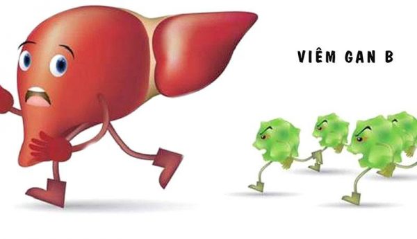 viêm gan B