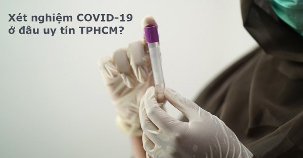Xét nghiệm COVID-19 ở đâu uy tín TPHCM? 10+ Địa chỉ nên tham khảo