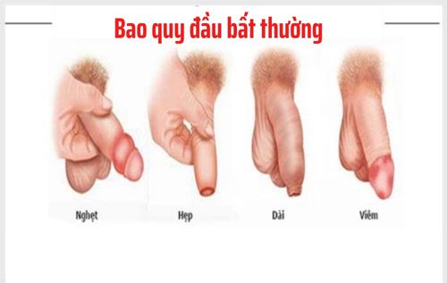 Hình ảnh bao quy đầu bình thường và bất thường ở người lớn