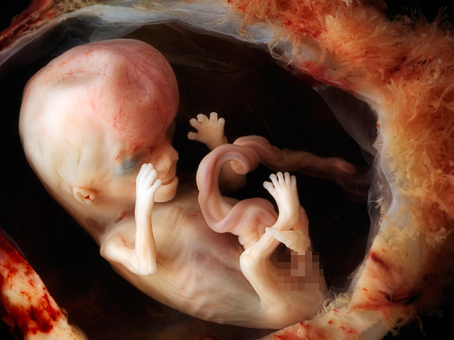 Đoán bầu nam hay nữ dựa vào chẵn và lẻ