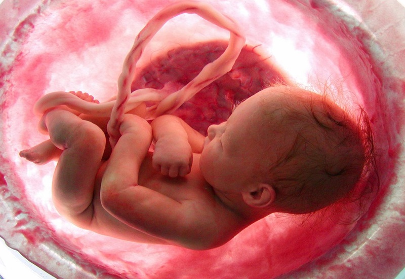 Vai trò của siêu âm đo chiều dài cổ tử cung trong dự phòng sinh non