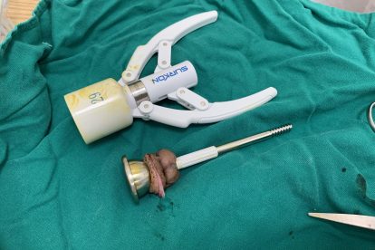 Top 5 địa chỉ cắt bao quy đầu ở đâu tốt nhất an toàn tại Bắc Ninh