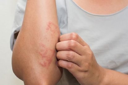Địa chỉ xét nghiệm khám bệnh xã hội ở đâu Bắc Ninh tốt nhất? TOP 7 địa chỉ uy tín không nên bỏ lỡ